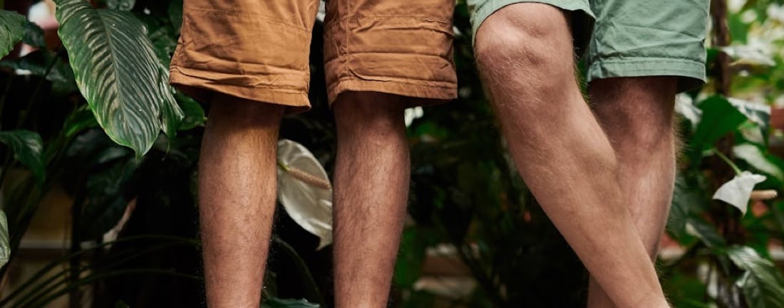 Le bermuda : La pièce mode qui fait son retour